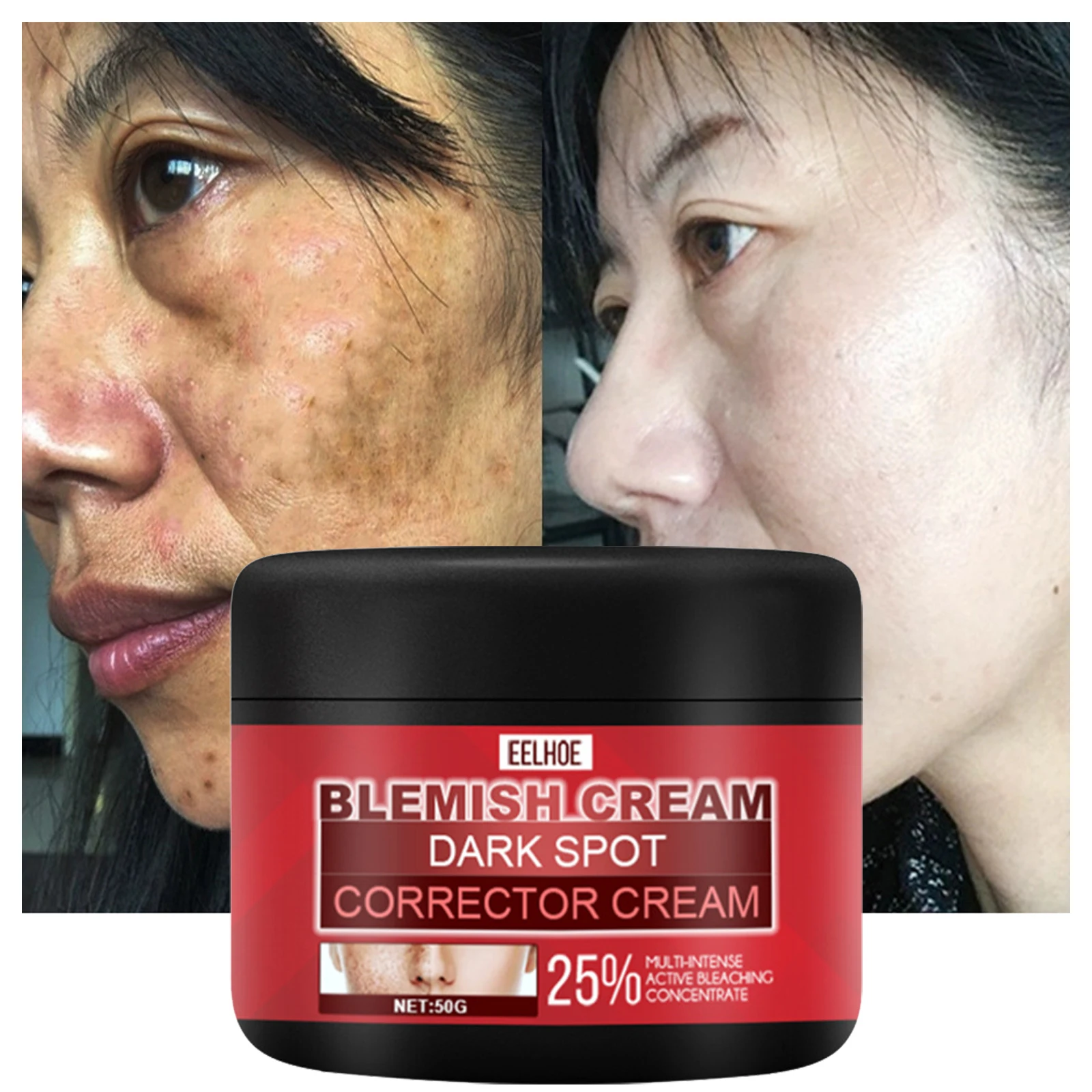

Freckle Whitening Cream Remove Fade Dark Spots Pigment Melanin Fade Blemish Firming Brightening Moisturizing Facial Care 50g