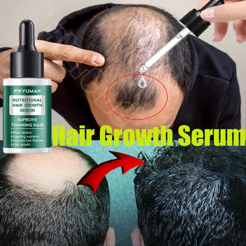 

Имбирные продукты для роста волос для мужчин и женщин, лечение выпадения волос, восстанавливающий питательный биотин, жидкий Уход за волосами