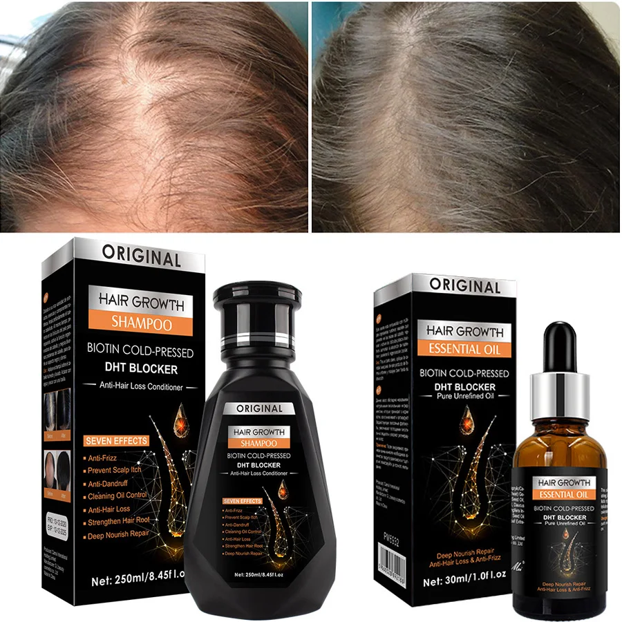 

2pcs/set Hair Growth Essential Oil Biotin Cold-Pressed DHT Blocker and Hair Growth Shampoo Anti-Hair Loss Conditioner