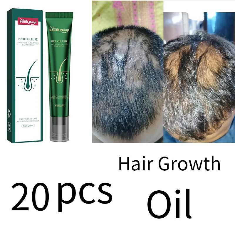 Новинка 2023, Biotin, масло для быстрого роста волос, сыворотка для восстановления роста волос, лечение истончения волос, жидкость для роста волос, против выпадения волос для женщин и мужчин
Новинка 2023, Biotin, масло для быстрого роста волос, сыворотка для восстановления роста волос, лечение истончения волос, жидкость для роста волос, против выпадения волос для женщин и мужчин