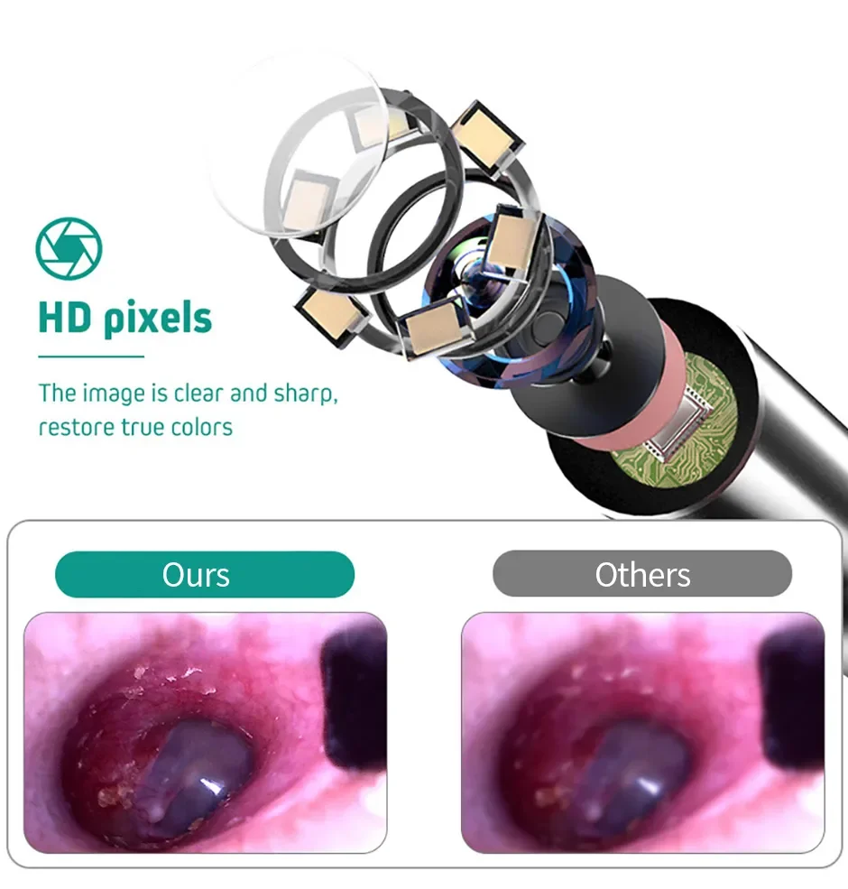 Ear Cleaning Endoscope 3 in 1 Ear Scope IP67 Waterproof Camera with 6 LED For Android Type C PC with Ear Pick Cleaning Kit 7 Mallzona S8c3e8a7e2e2d4b67a6f6d0de04f23590h Ear Cleaning Endoscope 3 in 1 Ear Scope IP67 Waterproof Camera with 6 LED For Android Type C PC with Ear Pick Cleaning Kit Mallzona