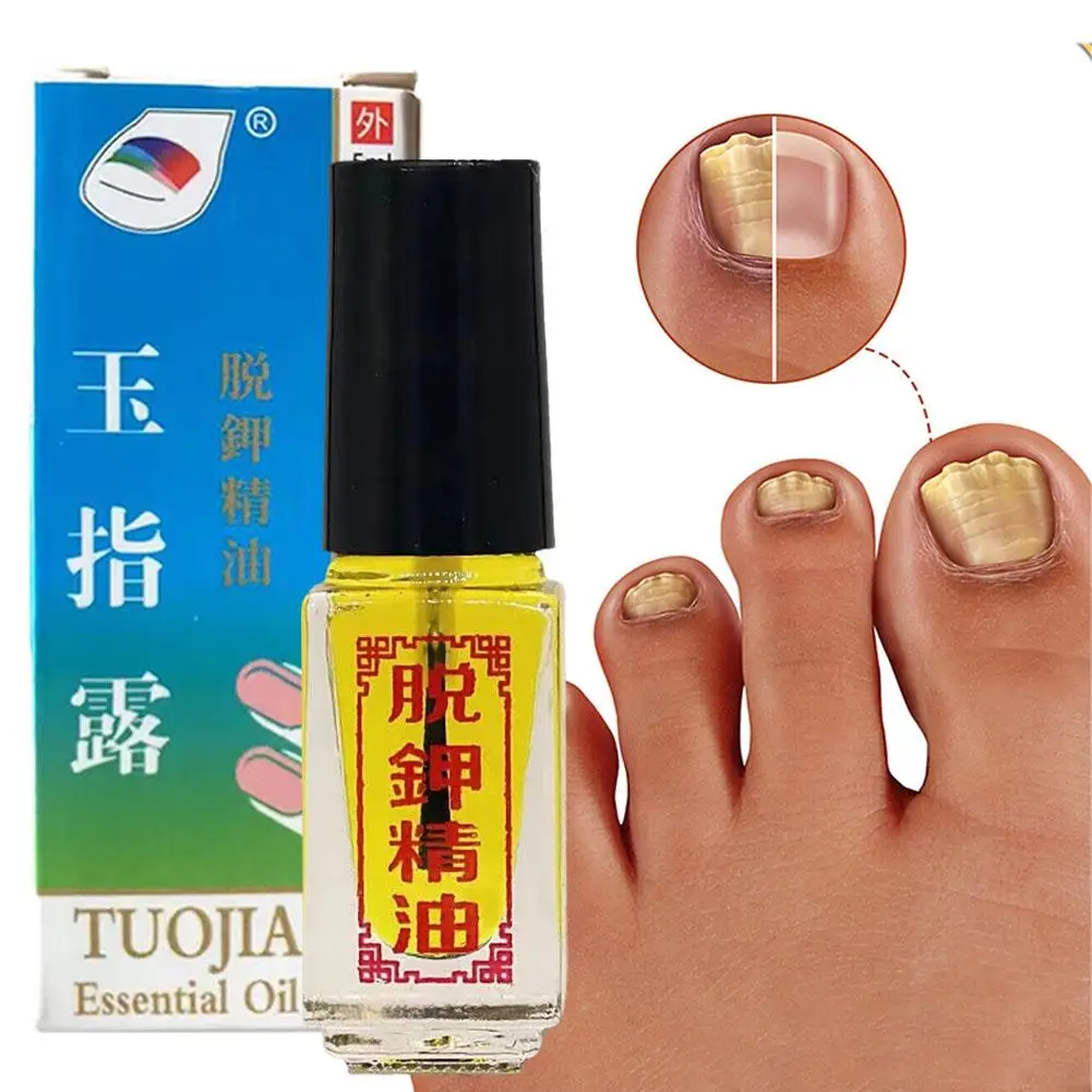 Nail Fungus Treatments Foot Care Toe Nails Fungal Removal Anti-Infection Hand Onychomycosis Fungus Toe Gel Foot 3 Oil Effec H5G2
Nail Fungus Treatments Foot Care Toe Nails Fungal Removal Anti-Infection Hand Onychomycosis Fungus Toe Gel Foot 3 Oil Effec H5G2
