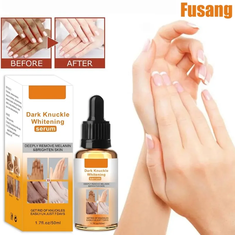 Brighten Knuckles Buttocks Whitening Serum Intimate Area Inner Thigh Bleaching Cream Remove Melanin Private Parts Whiten Essence
Brighten Knuckles Buttocks Whitening Serum Intimate Area Inner Thigh Bleaching Cream Remove Melanin Private Parts Whiten Essence