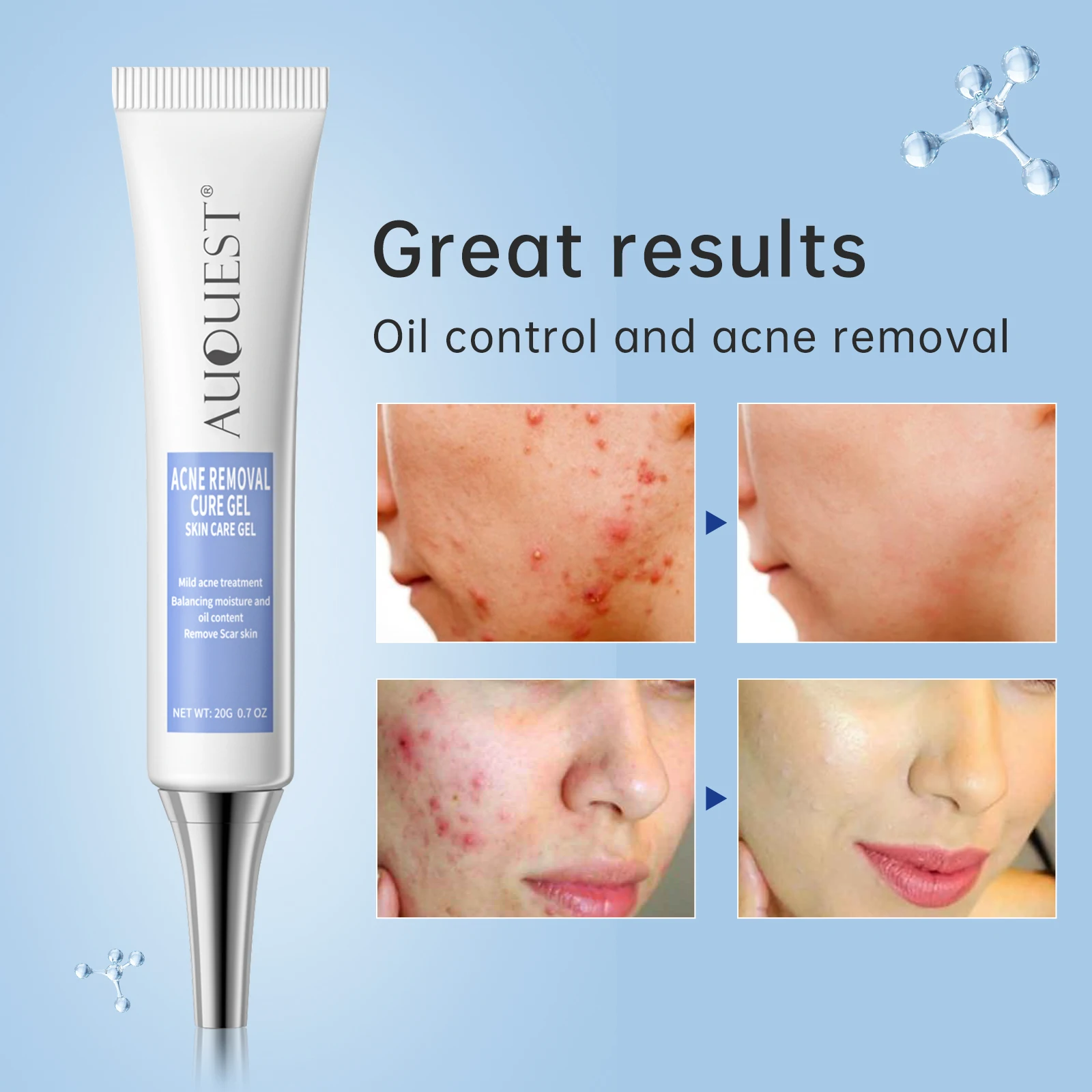 

Acid Pore Shrink Face Cream Hyaluronic Acid Moisturizing Nourish Smooth Pores Repair Essence Firm Korean Cosmetics