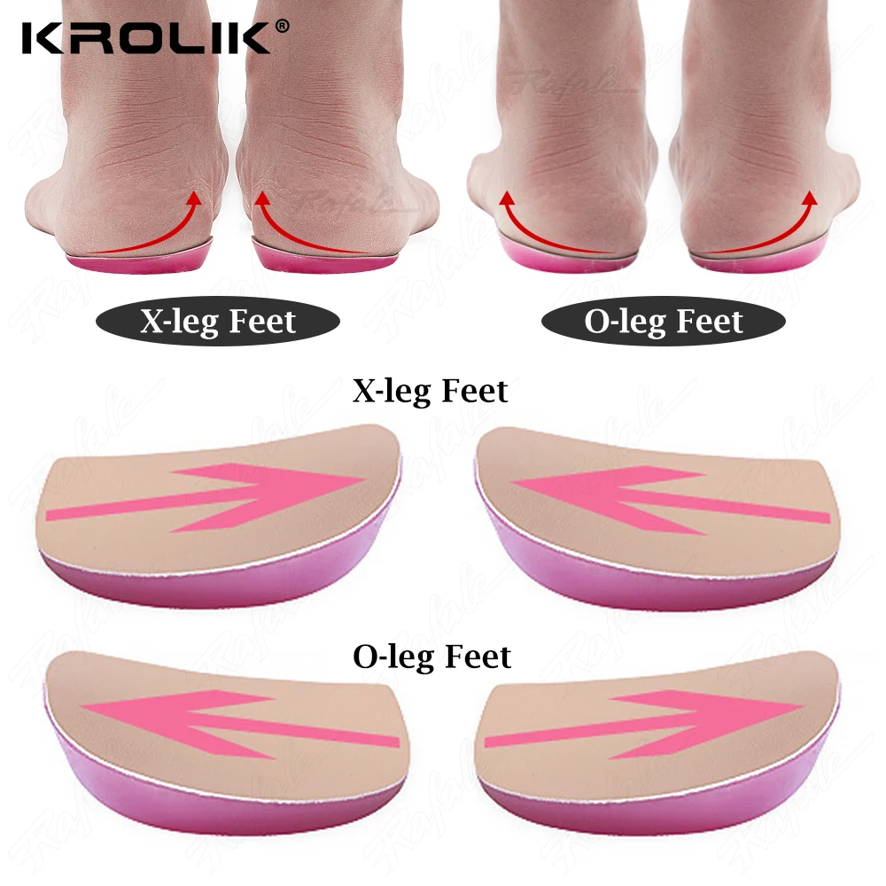 

XO Legs Orthopedic Shoes Insoles Silicone Gel Arch Support Pad For Women Flat Foot Orthotic Inserts Pain Relief High Heel Pads