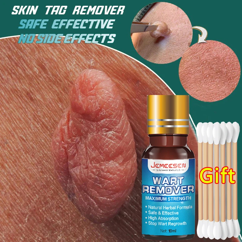 New Skin Tag Remover Wart Treatment Painless Mole Skin Dark Spot Wart Removal Serum Freckle Face Tags Remove Cream Essential Oil 
New Skin Tag Remover Wart Treatment Painless Mole Skin Dark Spot Wart Removal Serum Freckle Face Tags Remove Cream Essential Oil