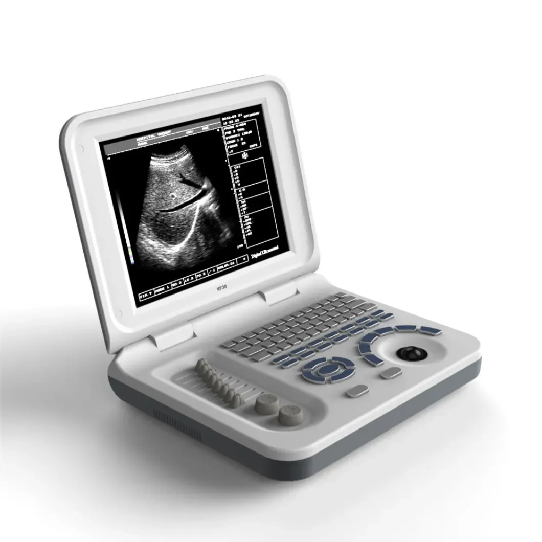 

Medical Full Digital Ultrasonido medico Price & Medical B&W Portable Ultrasound Scanner Machine With convex array probe