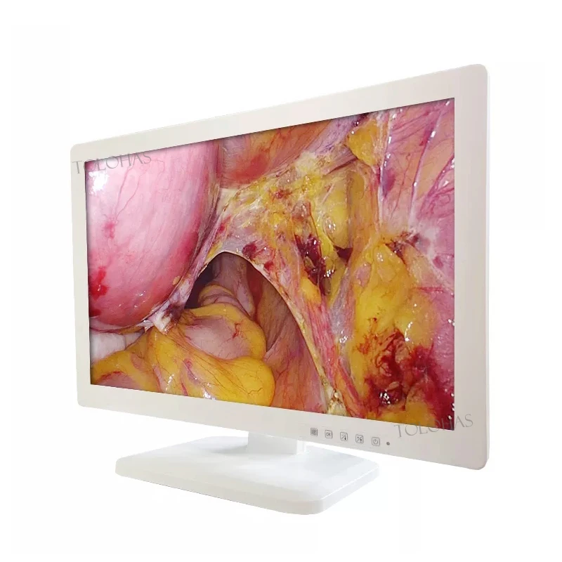 LHPM270 HD Medical Grade ENT 27 inch Surgical for Endoscopy Bronchoscope Hysteroscopy Laparoscopy
LHPM270 HD Medical Grade ENT 27 inch Surgical for Endoscopy Bronchoscope Hysteroscopy Laparoscopy