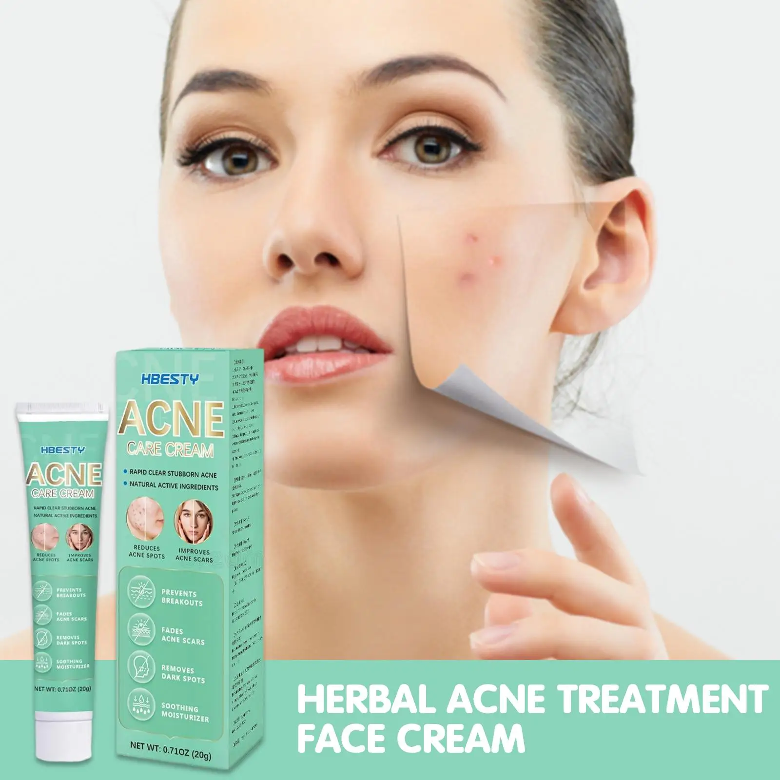 Herbal Acne Treatment Face Cream Oil Control Anti-Acne Removal Pimples Gel Care Shrink Acne Face Mark Eliminate Pores White W3S7
Herbal Acne Treatment Face Cream Oil Control Anti-Acne Removal Pimples Gel Care Shrink Acne Face Mark Eliminate Pores White W3S7