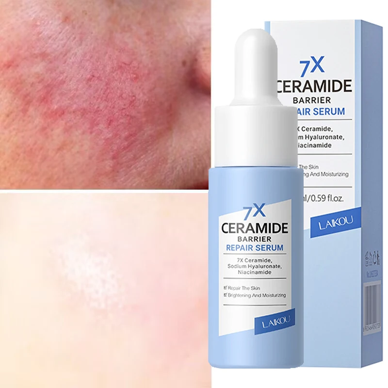 

Ceramide Repair Serum Remove Redness Relieve Sensitivity Dry Face Essence Whitening Soothing Moisturizing Skin Care Products