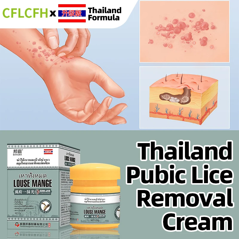 Pubic Lice Removal Treatment Spray Head Lice Eggs Mites Remover Antibacterial Scabies Anti-Itching Medicine Thailand Formula
Pubic Lice Removal Treatment Spray Head Lice Eggs Mites Remover Antibacterial Scabies Anti-Itching Medicine Thailand Formula