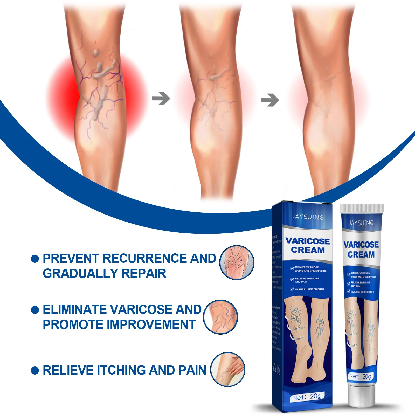 

Effective Varicose Vein Relief Cream Ointment For Varicose Veins To Relieve Vasculitis Phlebitis Spider Pain Treatment