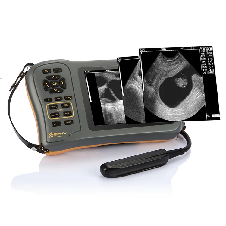 Portable handheld veterinary bovine equine swine sheep goat ultrasound machine for pregnant test and diagnosis
Portable handheld veterinary bovine equine swine sheep goat ultrasound machine for pregnant test and diagnosis