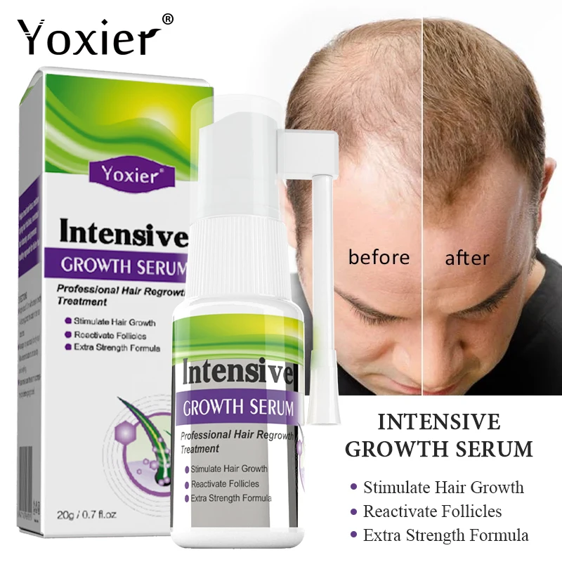 

Ginger Intensive Growth Serum Spray Anti Hair Loss Fast Regrowth Oil Control Repair Damaged Healthy Scalp Treatment Hair Care