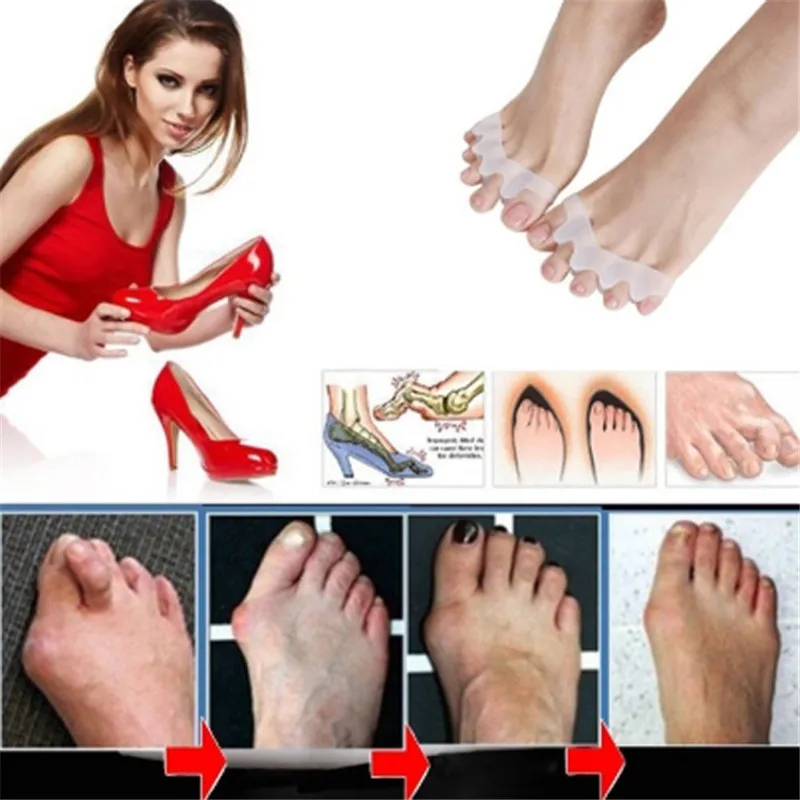 New Arrivals Foot Care Gel Bunion Protector Silicone Gel Hallux Valgus Correction Toe Separators Orthopedic Straightener
New Arrivals Foot Care Gel Bunion Protector Silicone Gel Hallux Valgus Correction Toe Separators Orthopedic Straightener