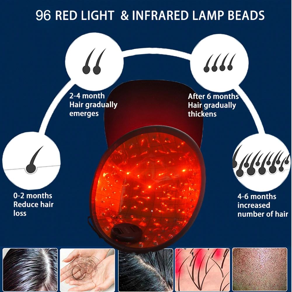 Lamp Beads Hair Growth Hat Cap Control laser Cap Hair Loss Treatment Therapy Instrument Anti Hair Loss Product in Care
Lamp Beads Hair Growth Hat Cap Control laser Cap Hair Loss Treatment Therapy Instrument Anti Hair Loss Product in Care