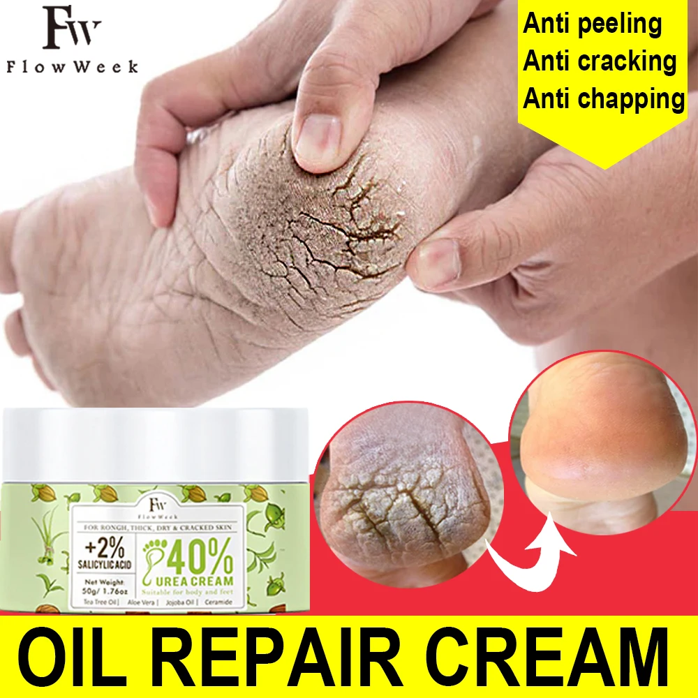 Anti Crack Foot Cream Anti-Drying Heel Cracked Repair Calluses Dead Skin Removal Moisturizing Hand Feet Care Beauty Health
Anti Crack Foot Cream Anti-Drying Heel Cracked Repair Calluses Dead Skin Removal Moisturizing Hand Feet Care Beauty Health
