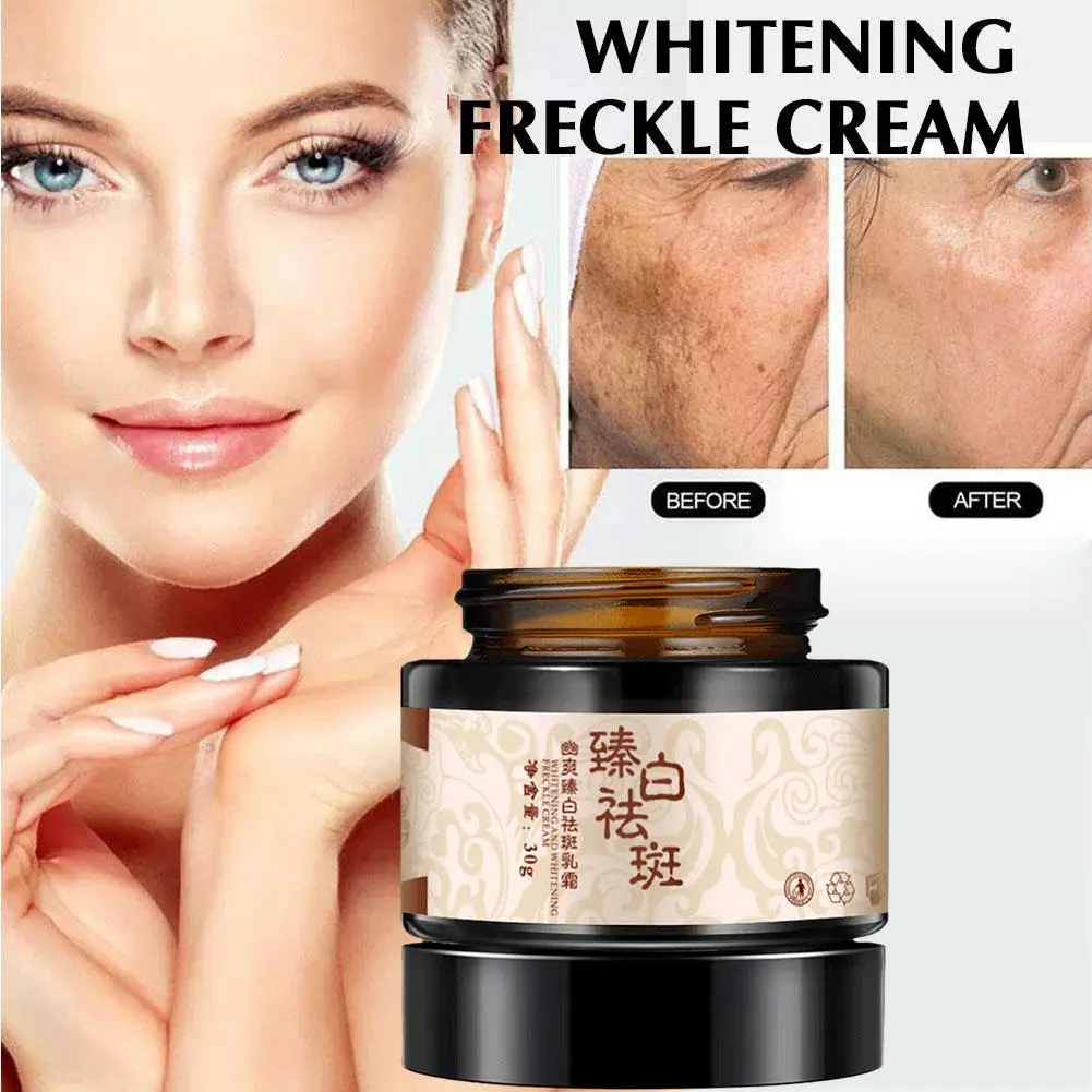

Powerful Whitening Freckle Cream Plant Face Cream Remove Freckles Dark Spots 30g For Skin Whitening M0L6