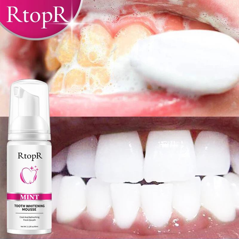 

RtopR 60ml Mousse Toothpaste Mint Oral Cleansing Tooth Fresh Tone Anti-decay Tooth Stain Removal Whitening Foam Oral Hygiene