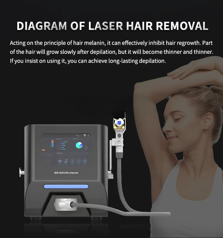 NEW 2000W Diode Laser Portable 755 808 1064nm Painless Permanent Skin Rejuvenation Hair Removal 808nm Best Hair Removal Results
NEW 2000W Diode Laser Portable 755 808 1064nm Painless Permanent Skin Rejuvenation Hair Removal 808nm Best Hair Removal Results