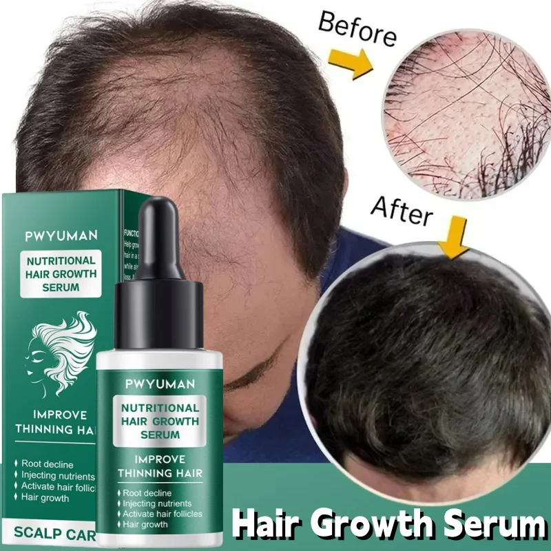 Hair Growth Essential Oil Prevent Hair Loss Anti-Baldness Hair Fast Regrowth Serum Scalp Nourishing Treatment Alopecia Hair Care
Hair Growth Essential Oil Prevent Hair Loss Anti-Baldness Hair Fast Regrowth Serum Scalp Nourishing Treatment Alopecia Hair Care