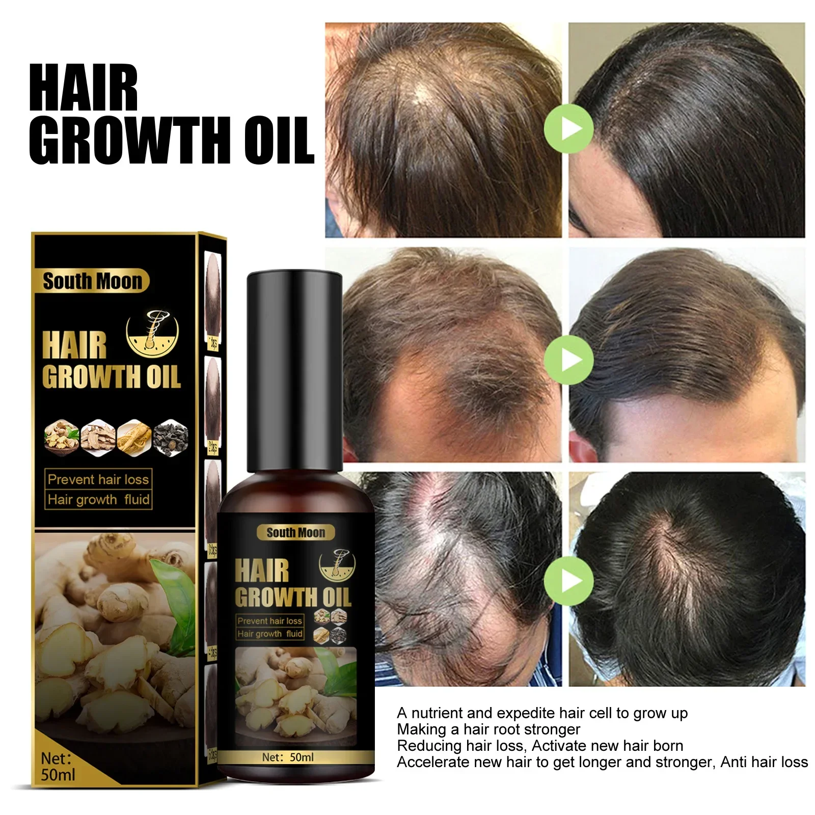 

Sdottor Rosemary Oil Hair Growth Products for Man Women Ginger Anti Hair Loss Fast Regrowth Thicken Oils Scalp Treatment Hair Ca