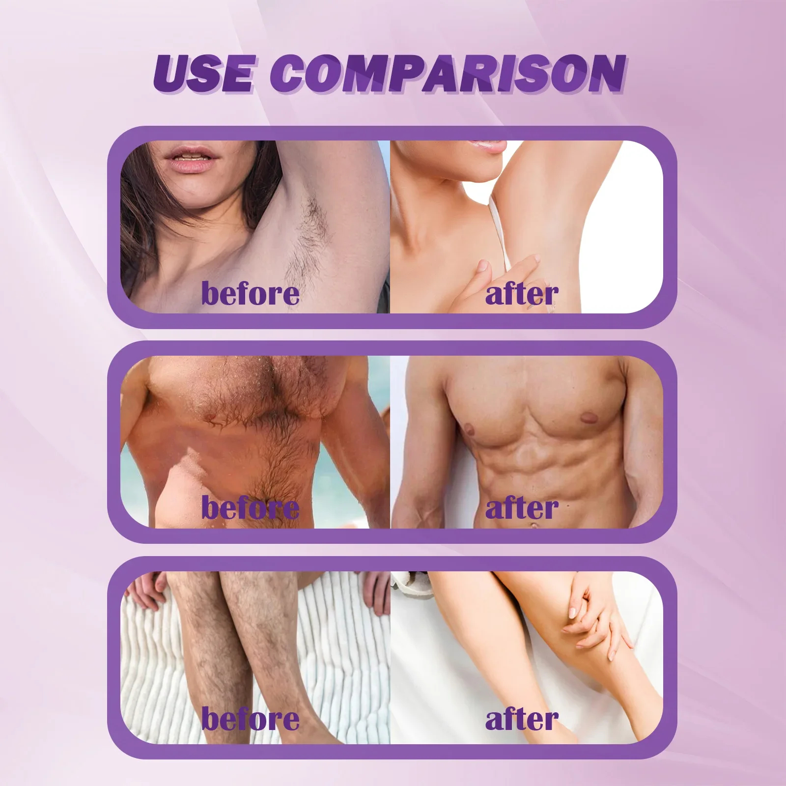 Sdottor Painless Hair Removal Cream Permanent Hair Growth Inhibitor Bikini Intimate Legs Armpit Hair Removal No Residue Depilato
Sdottor Painless Hair Removal Cream Permanent Hair Growth Inhibitor Bikini Intimate Legs Armpit Hair Removal No Residue Depilato