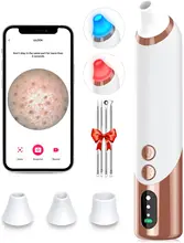 Blackhead Remover Pore Vacuum with Camera Pimple Extractor Kit, WiFi Visible Pore Cleaner USB Rechargeable Black Head Remover
Blackhead Remover Pore Vacuum with Camera Pimple Extractor Kit, WiFi Visible Pore Cleaner USB Rechargeable Black Head Remover
