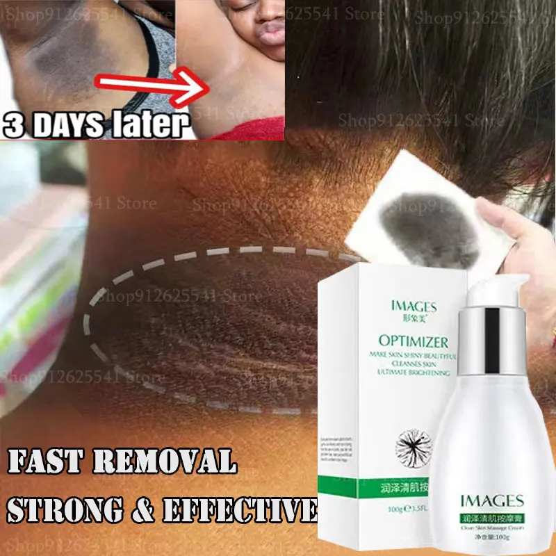 100g Fast Whitening Cream Face Washing Product Bleaching Cream for Black Skin Underarm Knee Buttocks Private Remove Melanin
100g Fast Whitening Cream Face Washing Product Bleaching Cream for Black Skin Underarm Knee Buttocks Private Remove Melanin