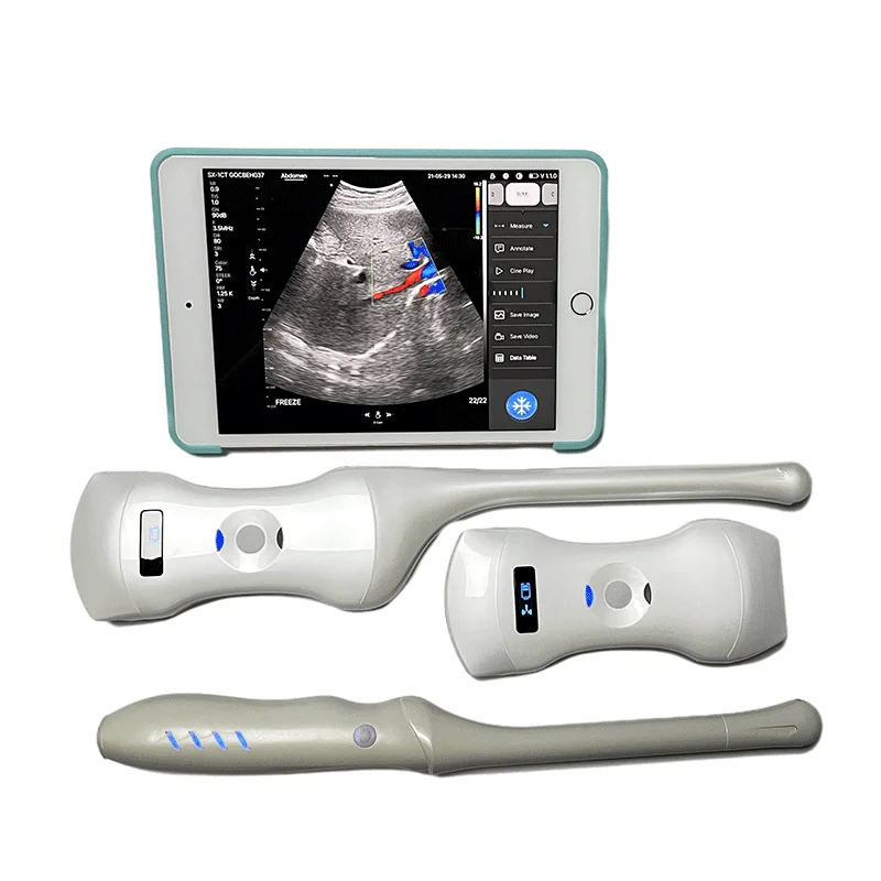 

3 in 1 Phased Array Cardiac Linear & Convex Color Doppler Ultrasound Scanner Siterite Vascular Wireless Ultrasound Probe