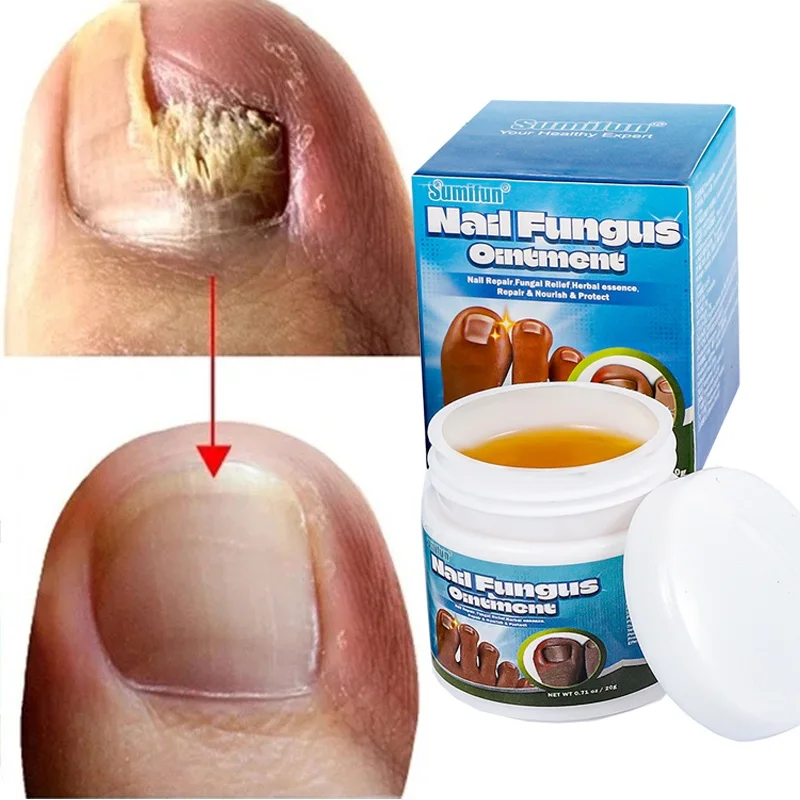 Effective Nail Fungus Treatment Cream Foot Toe Nail Fungus Removal Serum Anti-infection Paronychia Onychomycosis Repair Gel Care
Effective Nail Fungus Treatment Cream Foot Toe Nail Fungus Removal Serum Anti-infection Paronychia Onychomycosis Repair Gel Care