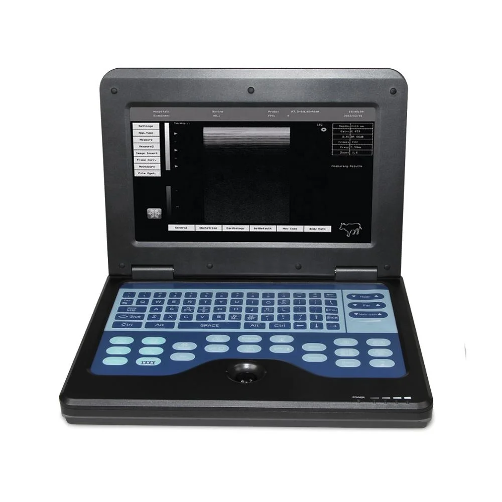 

CONTEC CMS600P2 10.1 inch Digital cheap portable doppler ultrasound machine
