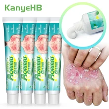 4pcs Psoriasis Treatment Ointment Tinea Cruris Red Rash Relieve Itch Medical Cream Tinea Corporis Dermatitis Eczema Cream A865 
4pcs Psoriasis Treatment Ointment Tinea Cruris Red Rash Relieve Itch Medical Cream Tinea Corporis Dermatitis Eczema Cream A865
