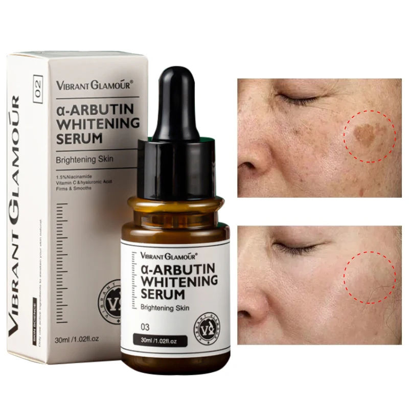Whitening Serum Removal Freckles Melasma Moisturize Brighten Dark Spot Corrector Nourishing Repair Fade Dull Skin Face Care 30ml
Whitening Serum Removal Freckles Melasma Moisturize Brighten Dark Spot Corrector Nourishing Repair Fade Dull Skin Face Care 30ml