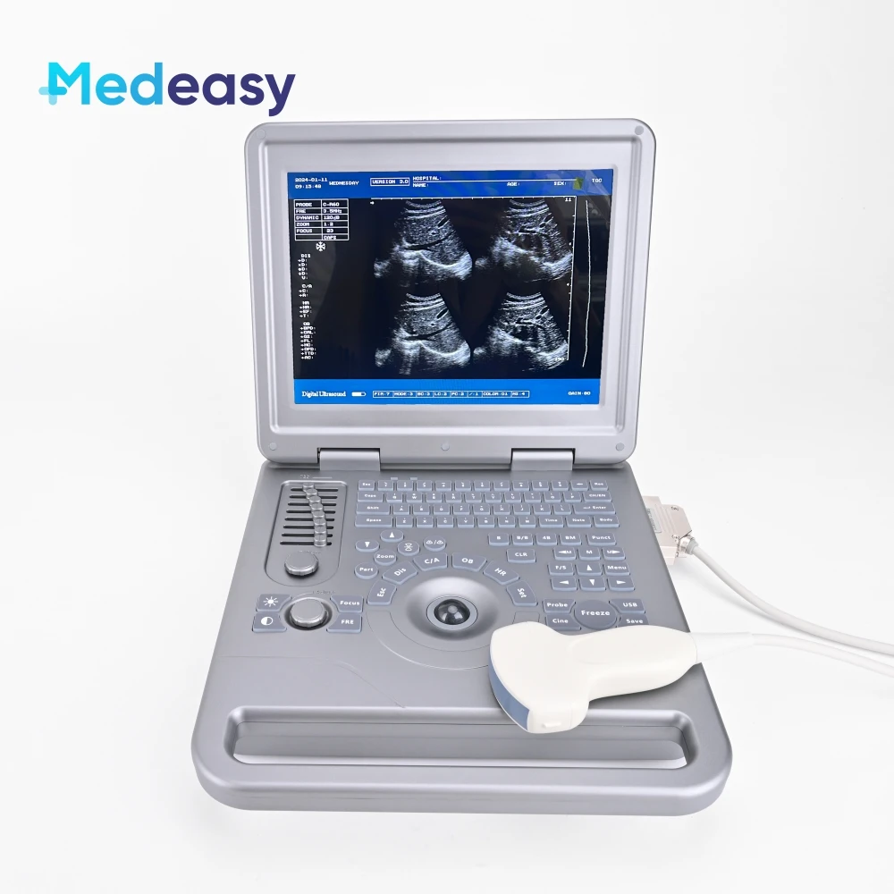 

Medical Handheld 12 Inch White and Black Ultrasound Machine Device Ultrasound Scanner System with Convex Probe for Diagnosis