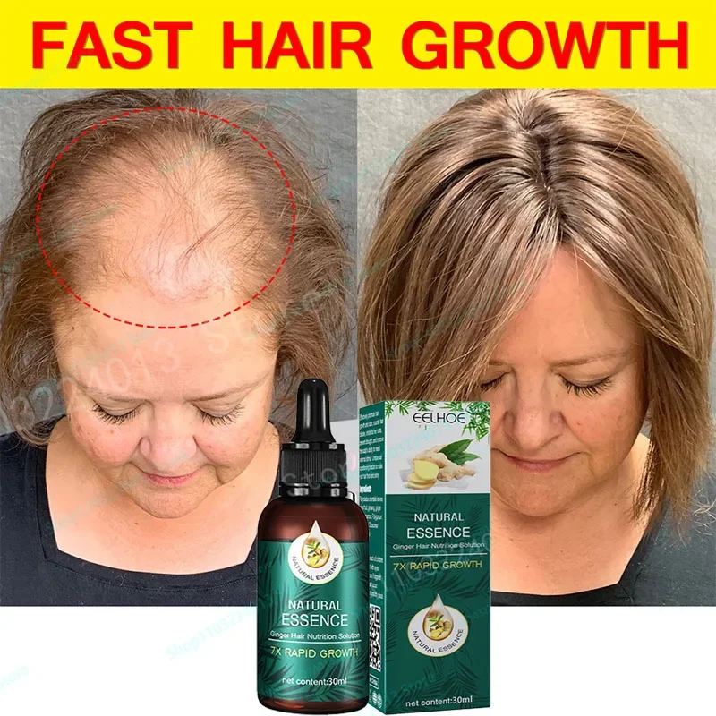 Natural Ginger Hair Growth Hair Roots Fast Grow Anti Hair Loss Serum Liquid Scalp Damaged Treatment Repair Beauty Health
Natural Ginger Hair Growth Hair Roots Fast Grow Anti Hair Loss Serum Liquid Scalp Damaged Treatment Repair Beauty Health