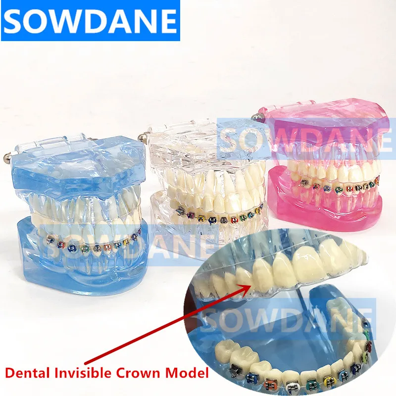 Новая Стоматологическая Ортодонтическая модель зубов для общения с пациентом, модель зубов для обучения стоматологии с невидимой прозрачной коронкой
Новая Стоматологическая Ортодонтическая модель зубов для общения с пациентом, модель зубов для обучения стоматологии с невидимой прозрачной коронкой