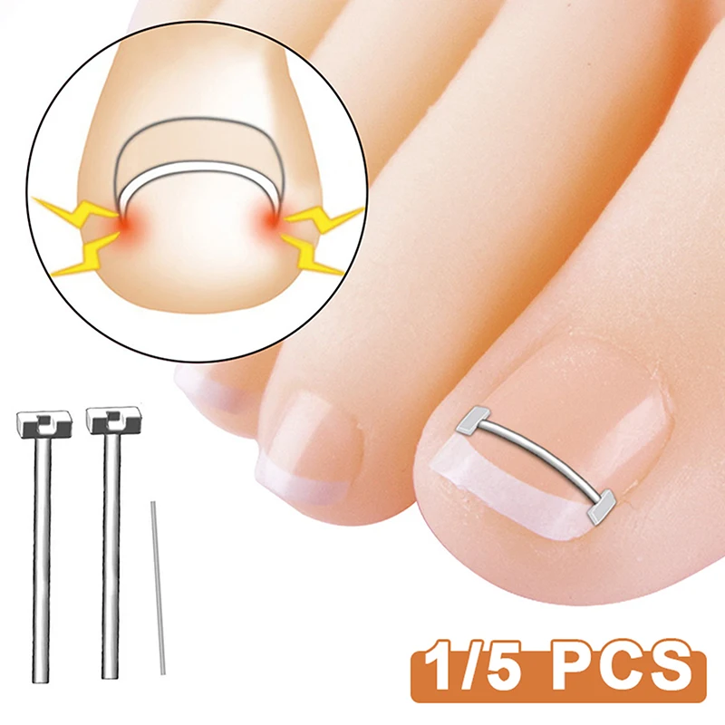 Professional Ingrown Toenail Correction Foot Care Tool Ingrown Toenail Corrector Tools Pedicure Recover Embed Toe Nail Treatment
Professional Ingrown Toenail Correction Foot Care Tool Ingrown Toenail Corrector Tools Pedicure Recover Embed Toe Nail Treatment