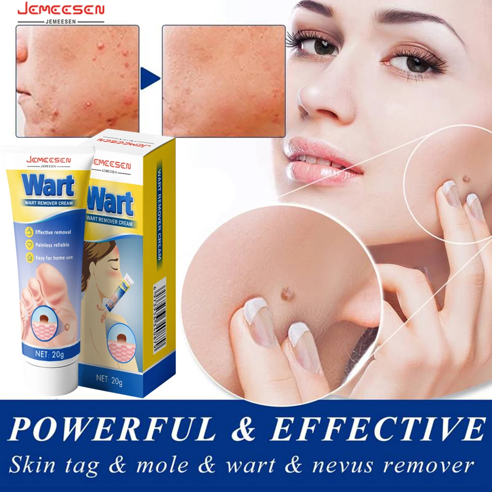 Jemeesen Warts Remover Antibacterial Ointment Wart Treatment Cream Clean Painless Remover Genital Herpes Papillomas Treatment
Jemeesen Warts Remover Antibacterial Ointment Wart Treatment Cream Clean Painless Remover Genital Herpes Papillomas Treatment