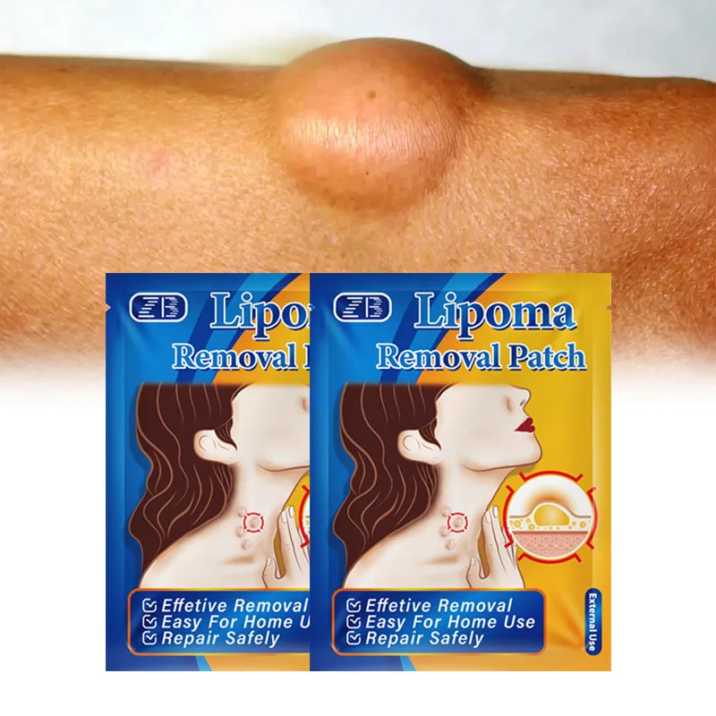 12Pcs Treatment Lipoma Removal Patch Removes Lipomas&Fibroids&Subcutaneous Lumps Pain Relief Medical Plaster 
12Pcs Treatment Lipoma Removal Patch Removes Lipomas&Fibroids&Subcutaneous Lumps Pain Relief Medical Plaster