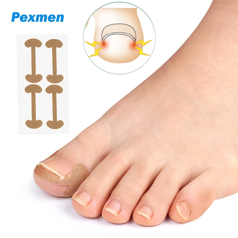 

Pexmen 4/8/20Pcs Ingrown Toenail Correction Sticker Adhesive Toenail Patch Foot Care Pedicure Kit Elastic Nail Corrector