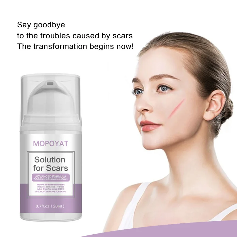 MOPOYAT Scar Remover Gel for Scars from C-Section, Stretch Marks, Acne, Surgery, Effective for both Old and New Scars 20g
MOPOYAT Scar Remover Gel for Scars from C-Section, Stretch Marks, Acne, Surgery, Effective for both Old and New Scars 20g