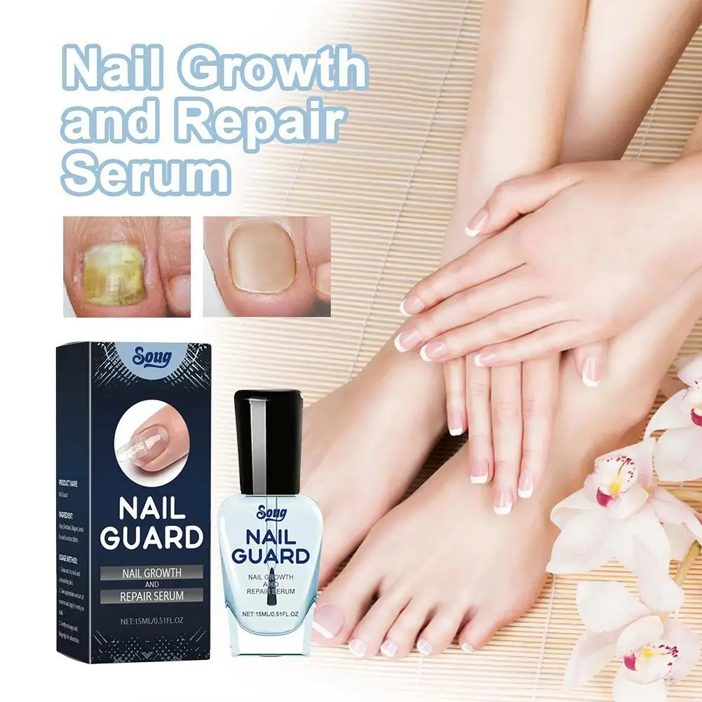 Nail Repairing Liquid Nail Strengthener Nourishing Cream Soft Shining Nail Repair Serum For Home Finger Toe Nail Care M1Z3
Nail Repairing Liquid Nail Strengthener Nourishing Cream Soft Shining Nail Repair Serum For Home Finger Toe Nail Care M1Z3