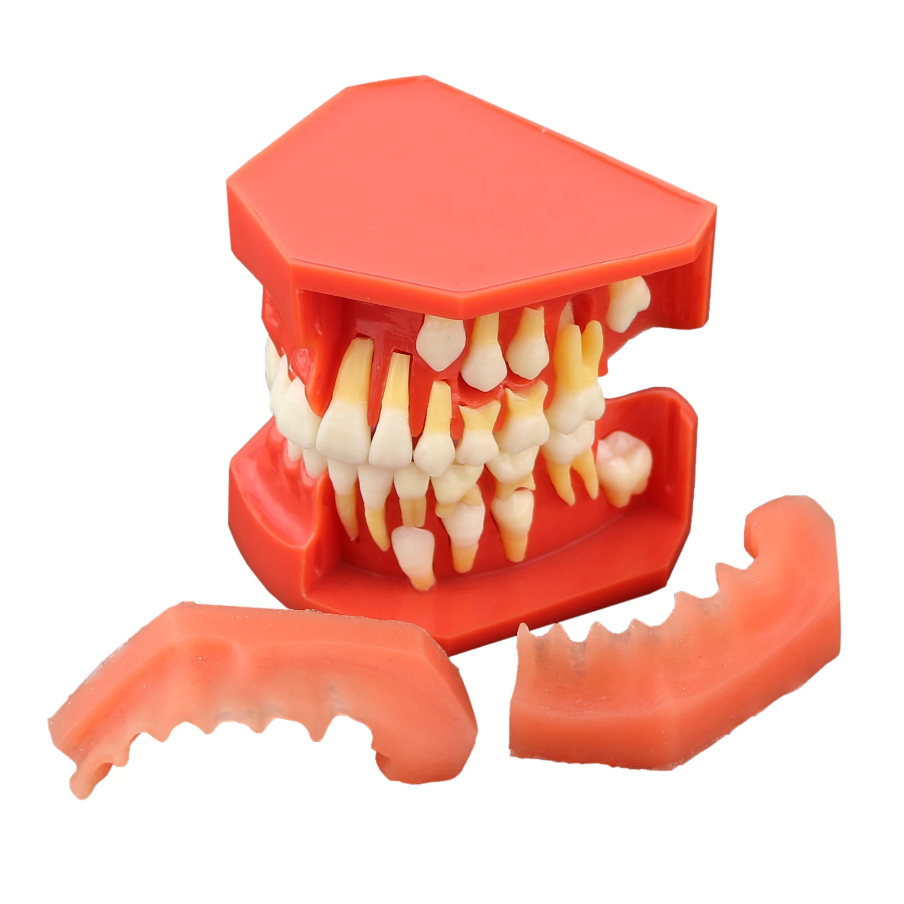 Dental Teeth Model M7013 Typodont Pediatric Development 9-12 Years Constant Teeth Grow Replace Demo Anatomy Teaching Study
Dental Teeth Model M7013 Typodont Pediatric Development 9-12 Years Constant Teeth Grow Replace Demo Anatomy Teaching Study