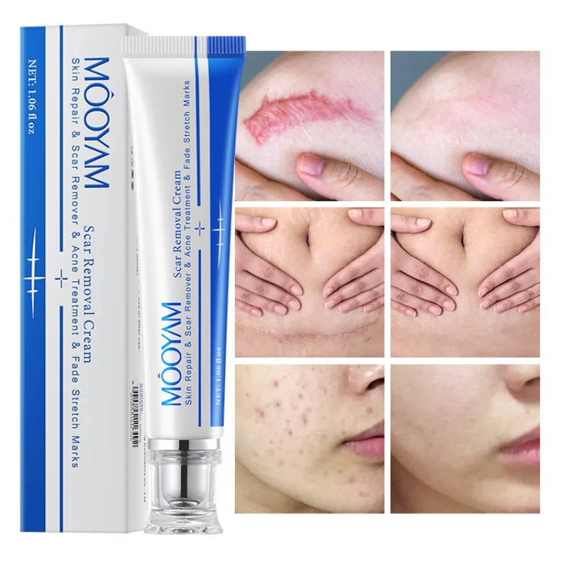 Herb Surgical Burn Scar Removal Ointment Gel Acne Promote Cell Regeneration Repair Cream Whitening Pigmentation Corrector
Herb Surgical Burn Scar Removal Ointment Gel Acne Promote Cell Regeneration Repair Cream Whitening Pigmentation Corrector