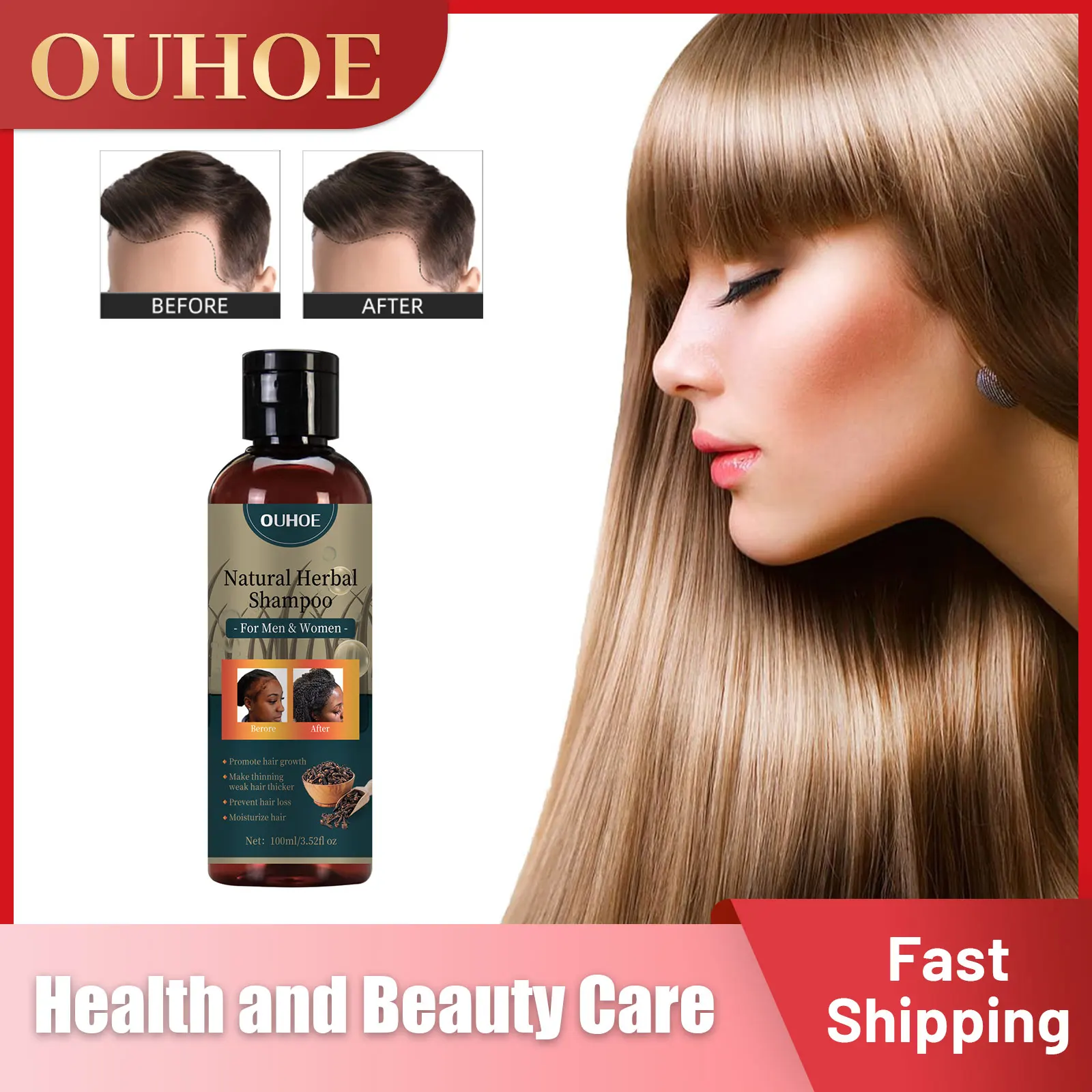Herbal Shampoo for Hair Growth Deep Cleaning Nourishing Strenghten Roots Scalp Treatment Anti Hair Loss Shampoo Men Women 100ml
Herbal Shampoo for Hair Growth Deep Cleaning Nourishing Strenghten Roots Scalp Treatment Anti Hair Loss Shampoo Men Women 100ml
