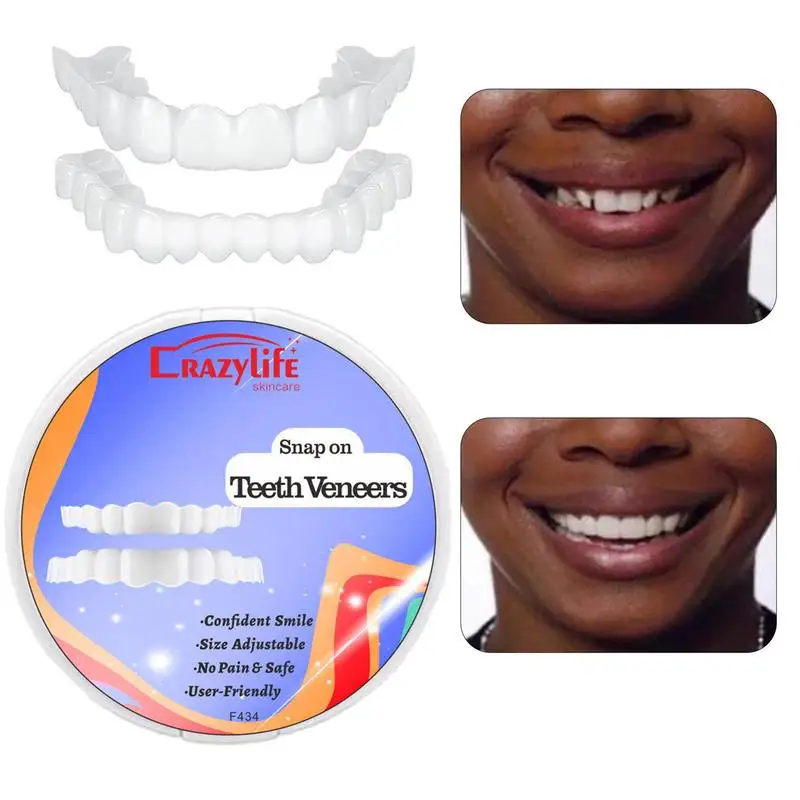 Fake Tooth Cover Snap On Teeth Veneers For Men And Women Cover The Teeth Fake Tooth Instant Confidence Smile Temporary Teeth
Fake Tooth Cover Snap On Teeth Veneers For Men And Women Cover The Teeth Fake Tooth Instant Confidence Smile Temporary Teeth