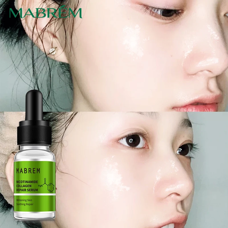 Niacinamide Serum Collagen Repair Face Essence Whitening Spots Oil Control Pore Reduction Acne Removal and Skin Tightening
Niacinamide Serum Collagen Repair Face Essence Whitening Spots Oil Control Pore Reduction Acne Removal and Skin Tightening