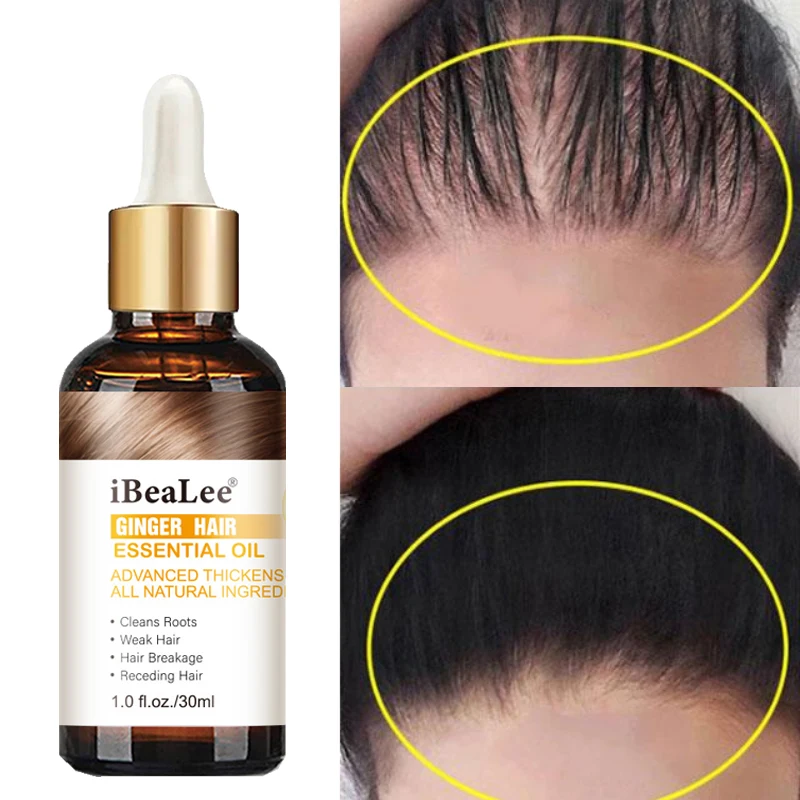 Hair Growth Serum Anti Hair Loss Essential Oil Repairs Thinning Hair Prevent Baldness Increased Volume Scalp Treatment Products
Hair Growth Serum Anti Hair Loss Essential Oil Repairs Thinning Hair Prevent Baldness Increased Volume Scalp Treatment Products