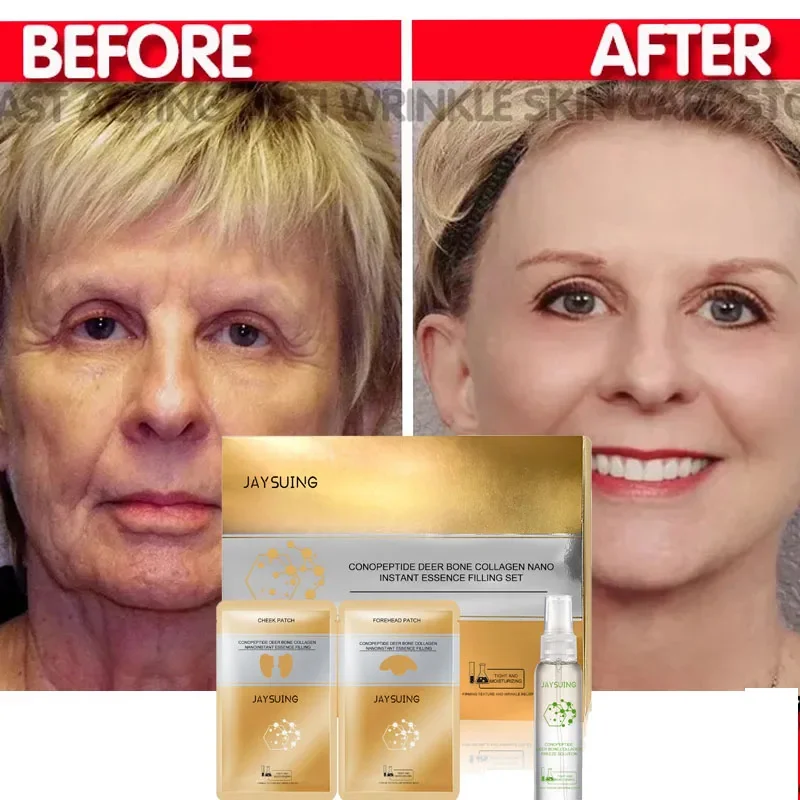 Collagen Wrinkle Remover Face Serum Set Anti-Aging Lifting Firming Fade Fine Lines Essence Moisturizing Whitening Face Skin Care
Collagen Wrinkle Remover Face Serum Set Anti-Aging Lifting Firming Fade Fine Lines Essence Moisturizing Whitening Face Skin Care